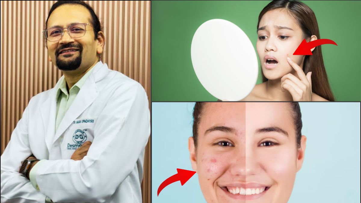 News24 Exclusive: Humidity Can Harm Your Skin- Dermatologist Dr Ranjan Upadhyay Shares Monsoon Skincare MUSTS