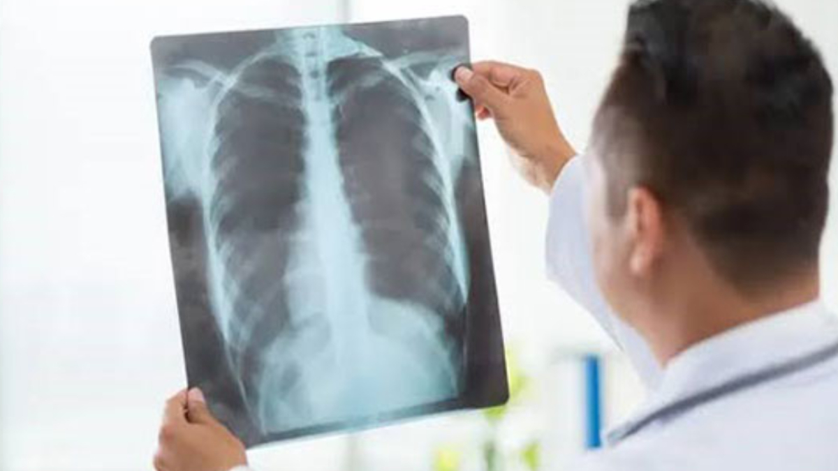 Google’s Medgemma Models Could Transform Healthcare Tech